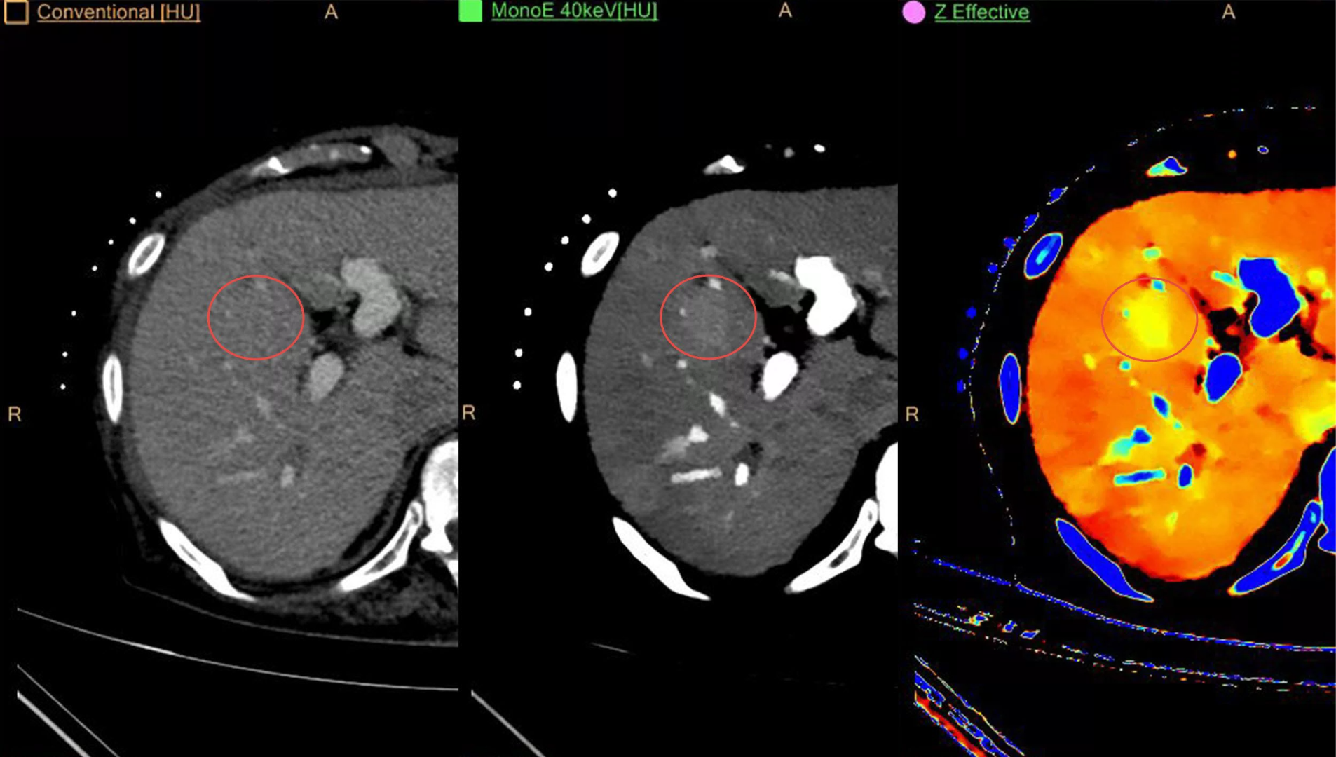 IQON Spectral CT. Philips IQON Spectral CT. Спектральная кт. Спектральные томографы.